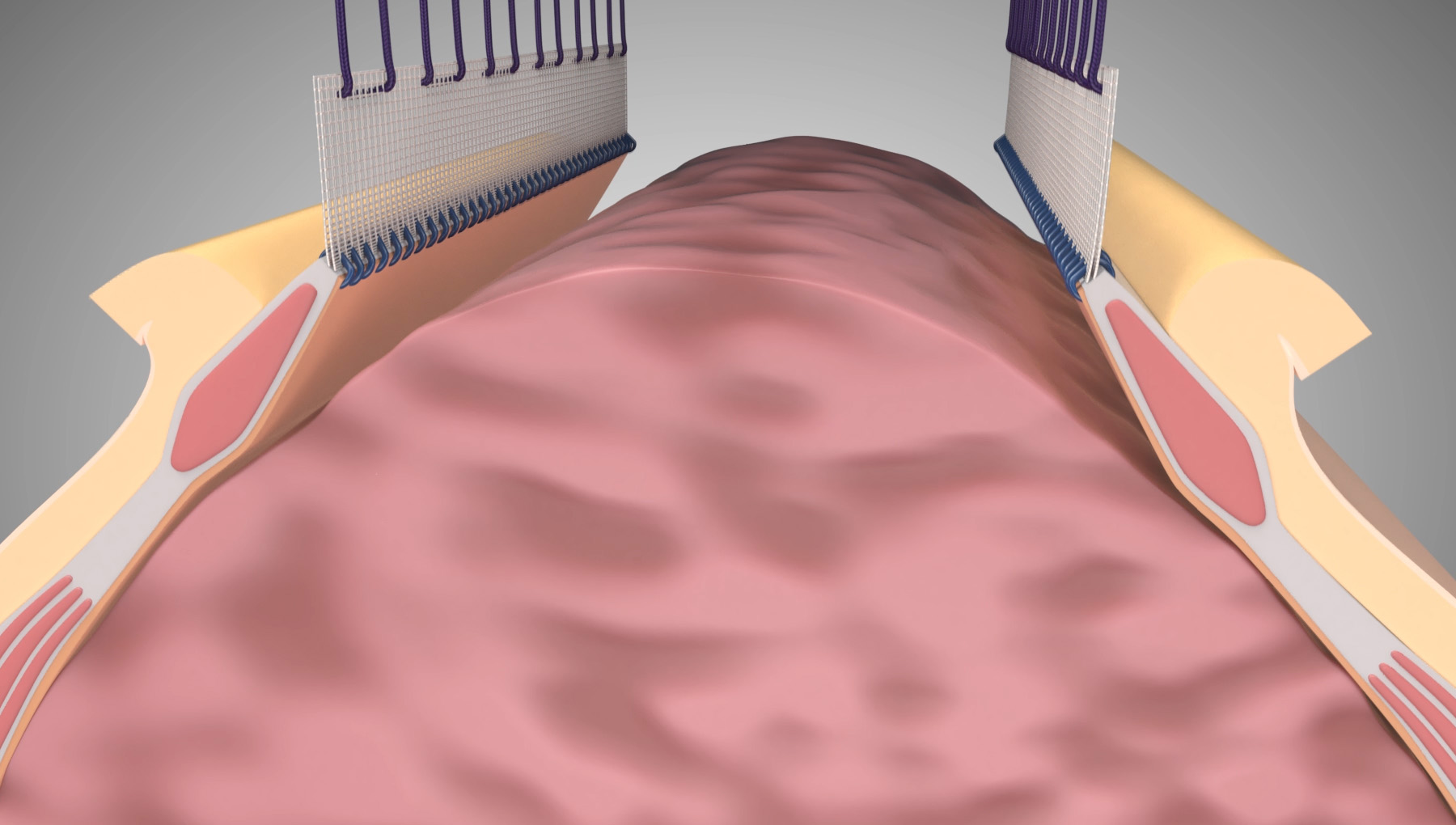 健康・医学 Fascia: The Tensional Network Fascia: The Tensional Network of the Human Body: The science